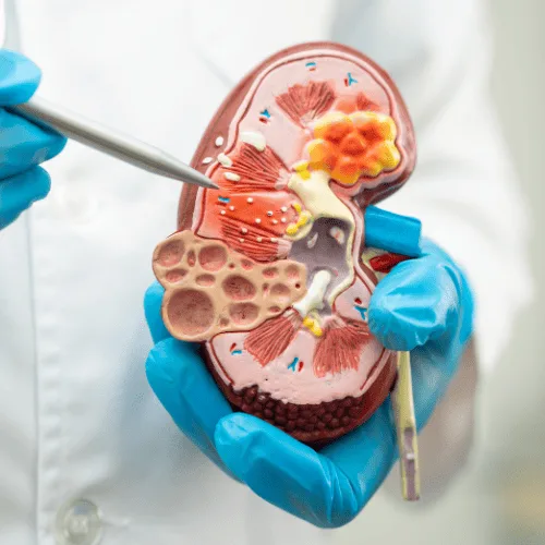 Diagnóstico y Tratamiento Especializado para el Dolor Testicular en CDMX